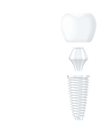 Один зуб за 20 минут